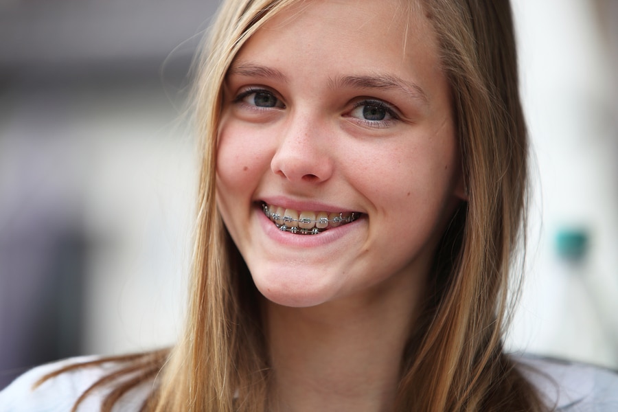 Young Teenage Girl With Orthodontic Braces.