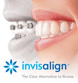 invisalign London Ontario