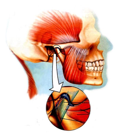 normal Jaw Joint TMJ London On Rondeau