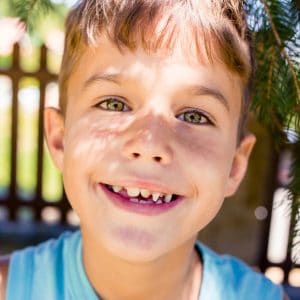 Child with crooked teeth wonders when he can get braces