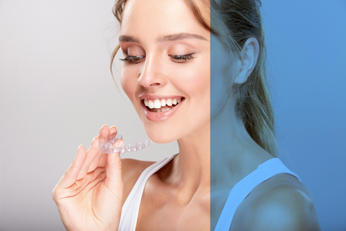 Woman holding clear aligner
